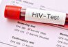 افزایش ۳ برابری شناسایی HIV با اجرای پویش سراسری
