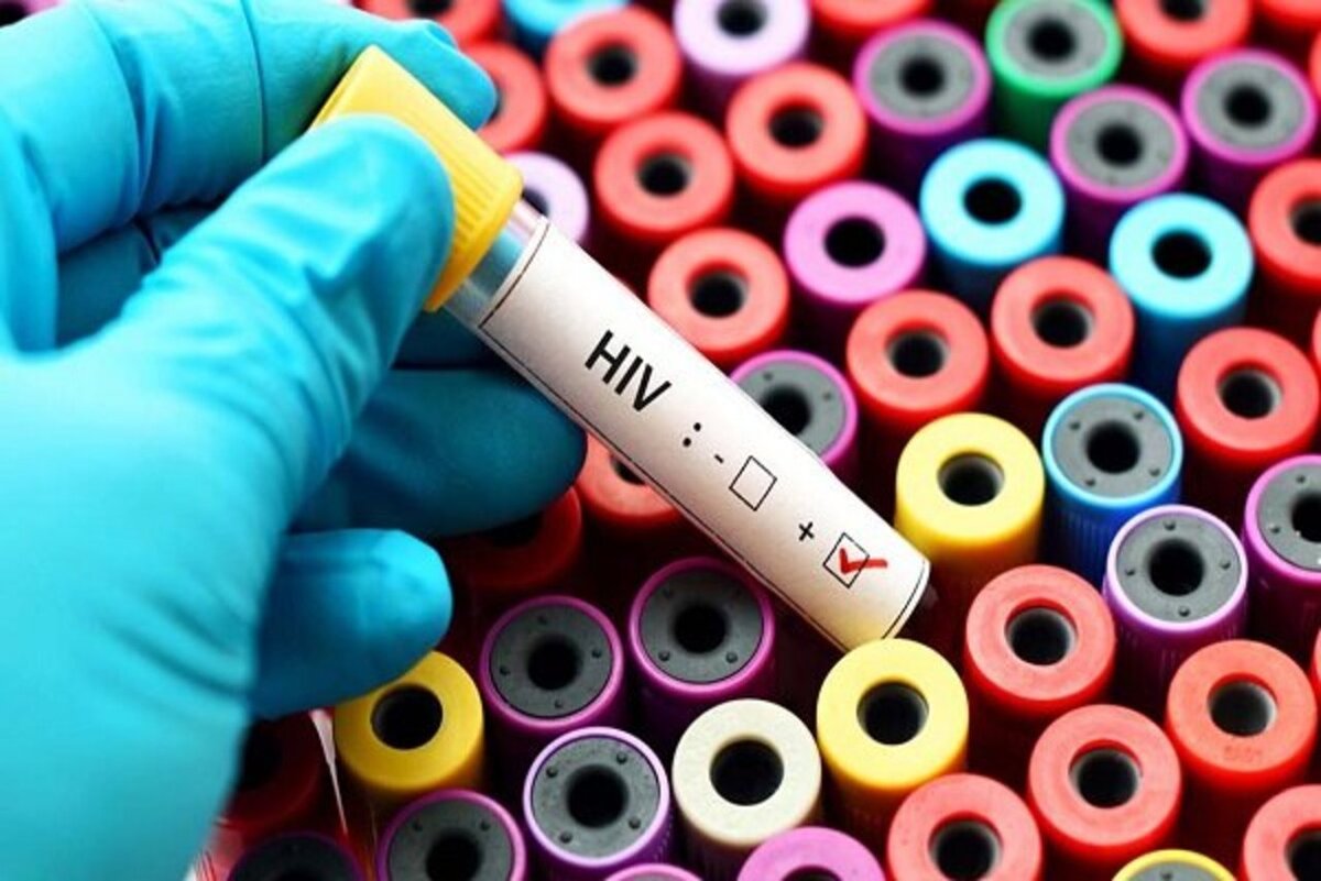هنوز واکسن مؤثری برای ویروس HIV ساخته نشده است