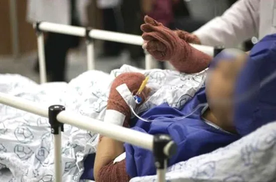 نارنجک باقی&zwnj;مانده از چهارشنبه&zwnj;سوری، انگشتان یک پاکبان را قطع کرد