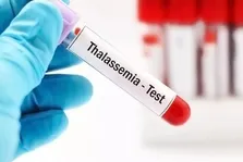 بیماران تالاسمی دیگر توان مصرف دارو‌های بی‌کیفیت را ندارند