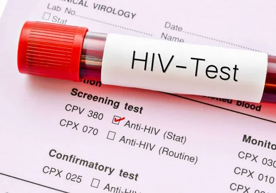 انگ اجتماعی بزرگ&zwnj;ترین مانع در کنترل HIV/اهمیت دسترسی به ابزار پیشگیری