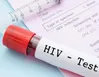 کاهش انتقال HIV از طریق اعتیاد تزریقی/تأکید بر تداوم برنامه‌های کاهش آسیب