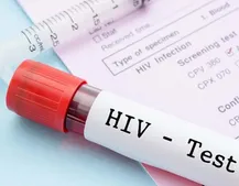 کاهش انتقال HIV از طریق اعتیاد تزریقی/تأکید بر تداوم برنامه‌های کاهش آسیب